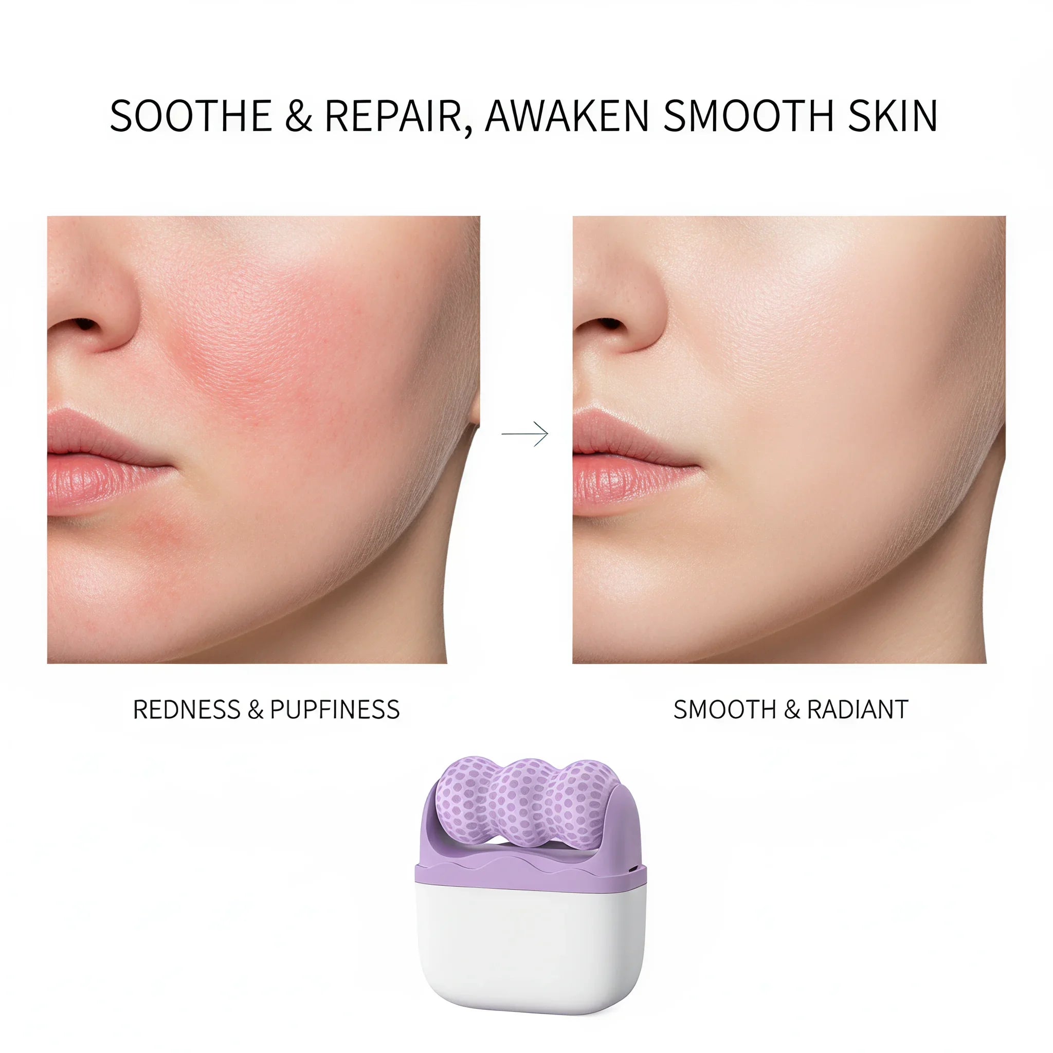 Everniva Cryo Roller — Cooling Facial Sculptor