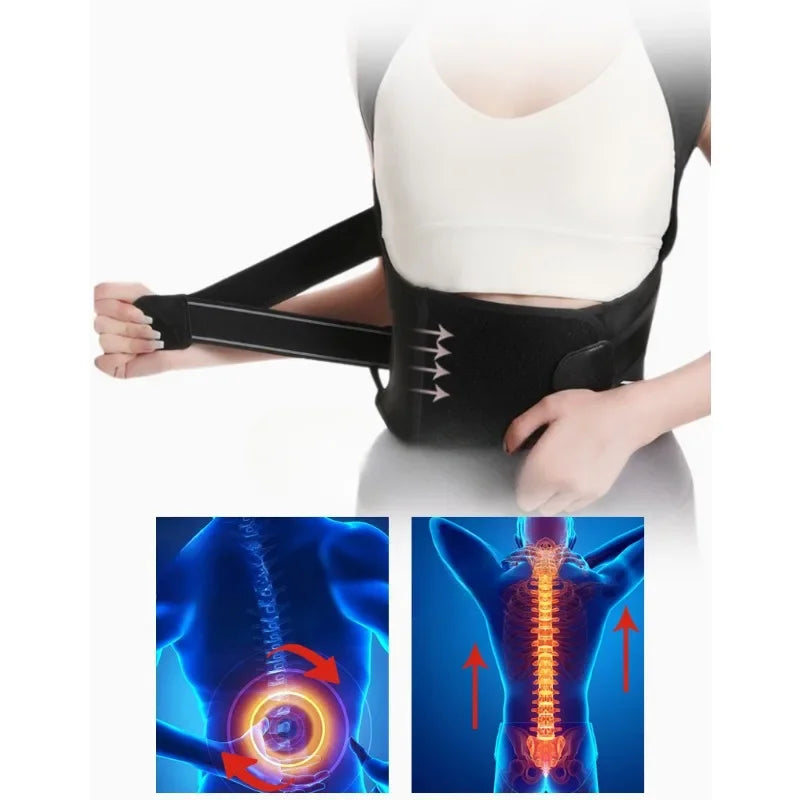 Everniva Posture Corrector